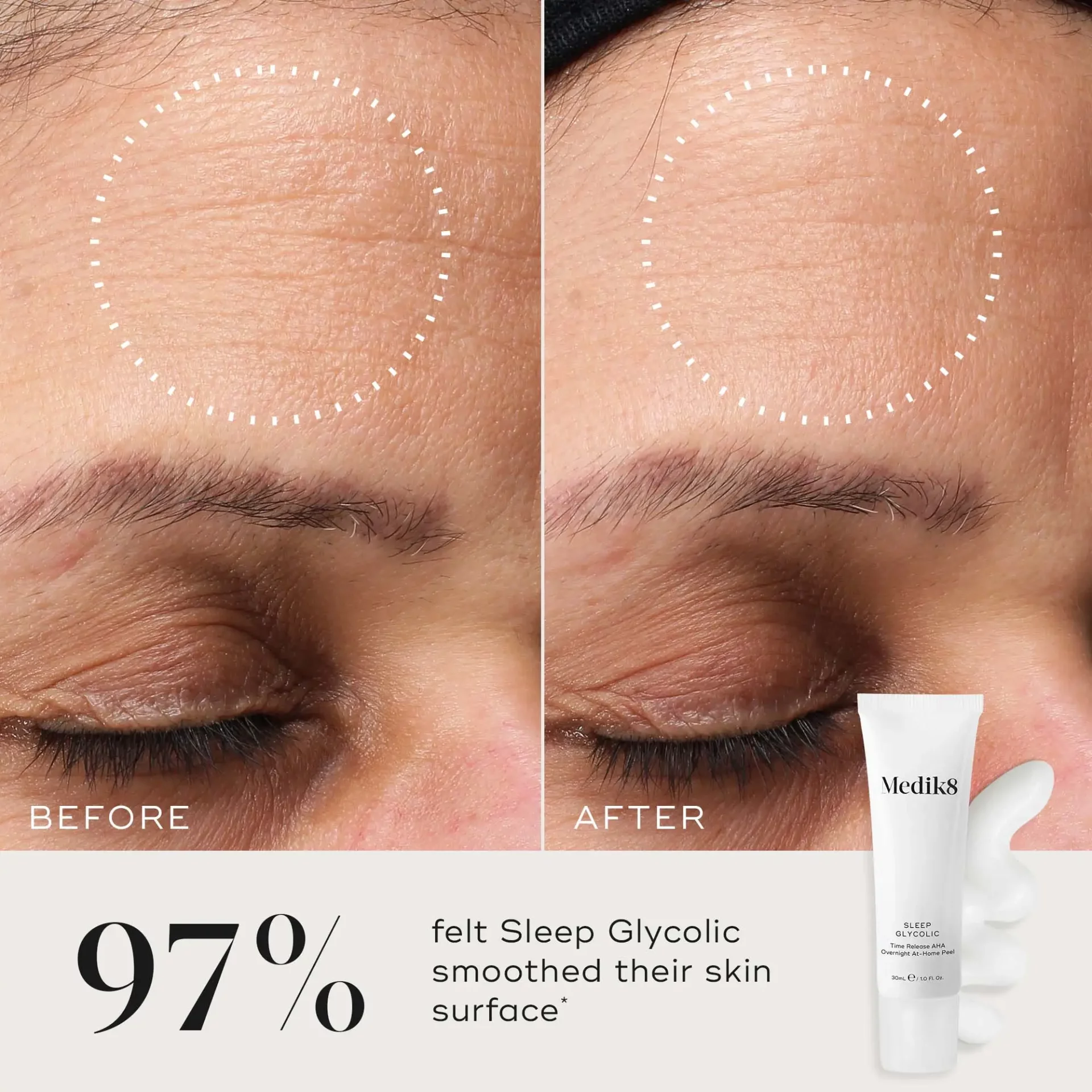 PDP Asset 3 Sleep Glycolic B&A ROW